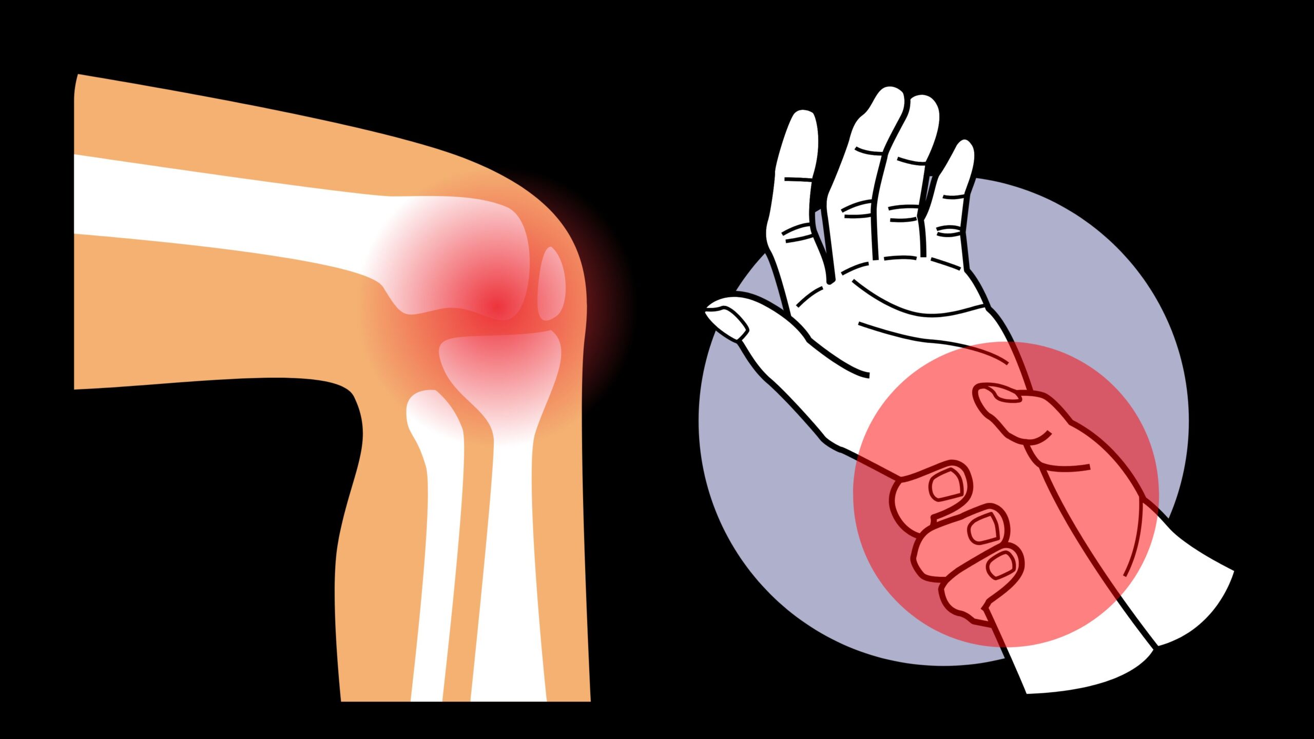 JOINT PAIN 1 JOINT PAIN 1